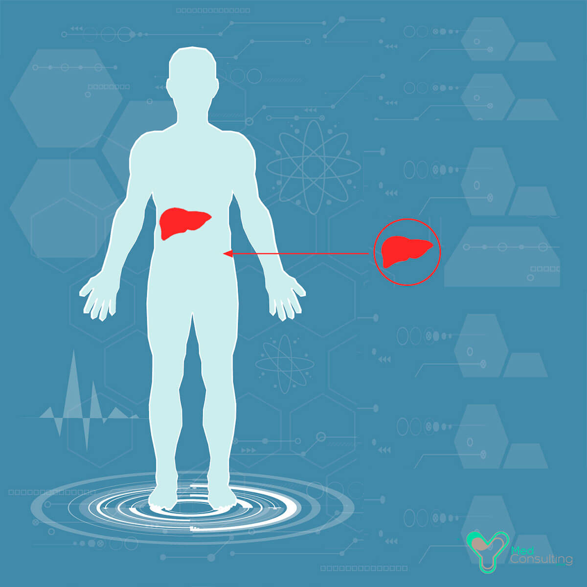 Лечение цирроза печени в Германии у лучших специалистов : YY MedConsulting  GmbH